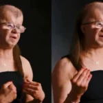 Jovem com doença rara que causa morte precoce inspira pessoas a viverem com propósito, esperança e confiança em Deus. Foto: Reprodução/Instagram/knzsvisuals