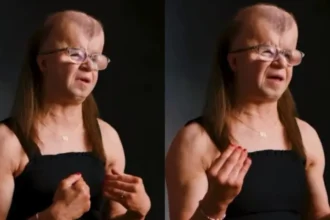 Jovem com doença rara que causa morte precoce inspira pessoas a viverem com propósito, esperança e confiança em Deus. Foto: Reprodução/Instagram/knzsvisuals