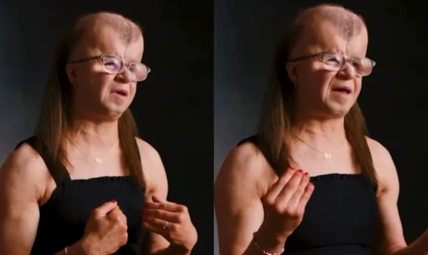 Jovem com doença rara que causa morte precoce inspira pessoas a viverem com propósito, esperança e confiança em Deus. Foto: Reprodução/Instagram/knzsvisuals