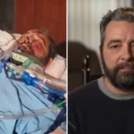 Um homem sobreviveu a um grave atropelamento nos EUA e chamou a atenção dos médicos pela recuperação considerada surpreendente. Foto: Reprodução/CBN News