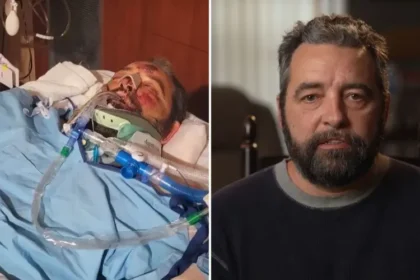 Um homem sobreviveu a um grave atropelamento nos EUA e chamou a atenção dos médicos pela recuperação considerada surpreendente. Foto: Reprodução/CBN News