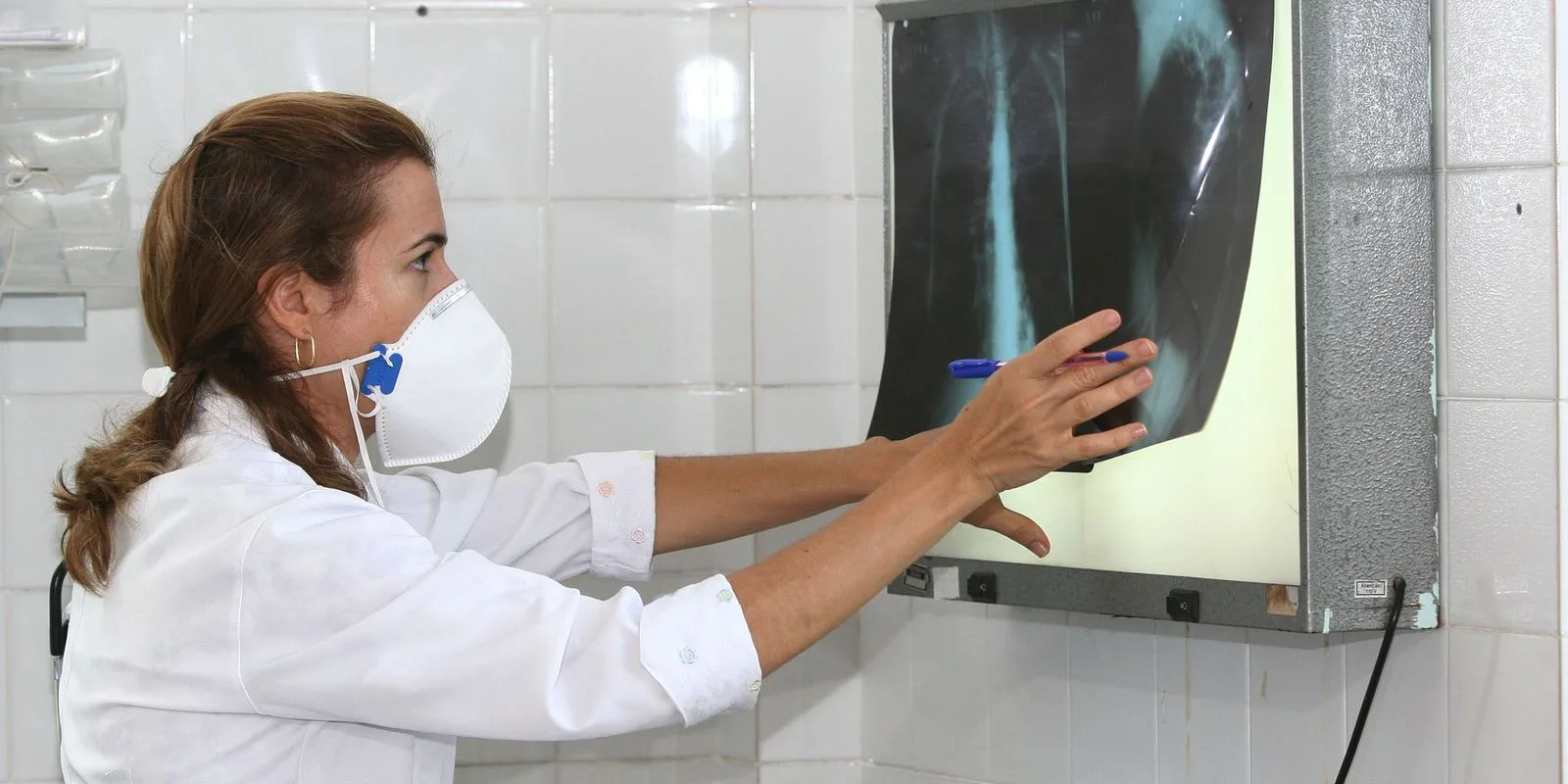 Consulta sobre medicamento para tratamento mais curto da tuberculose
