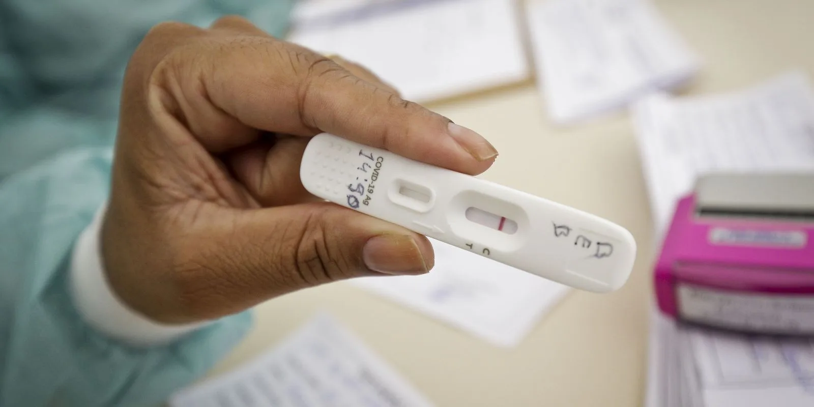 UFRJ afirma que índice de positividade de testes de covid-19 aumentou de 4% para 13%