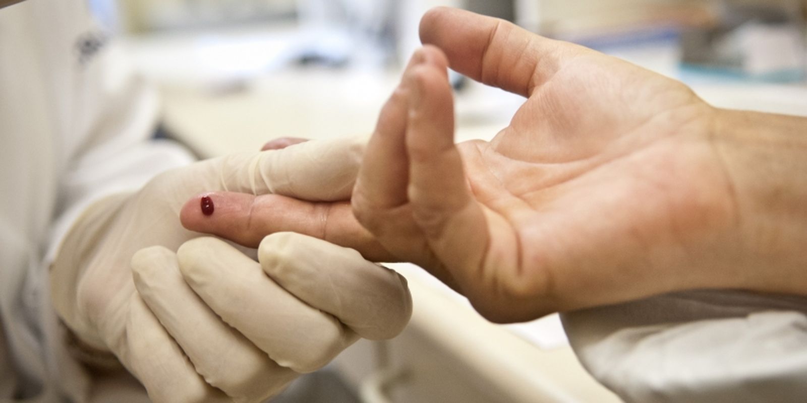 Aumento de casos de sífilis e HIV/aids entre jovens do sexo masculino.