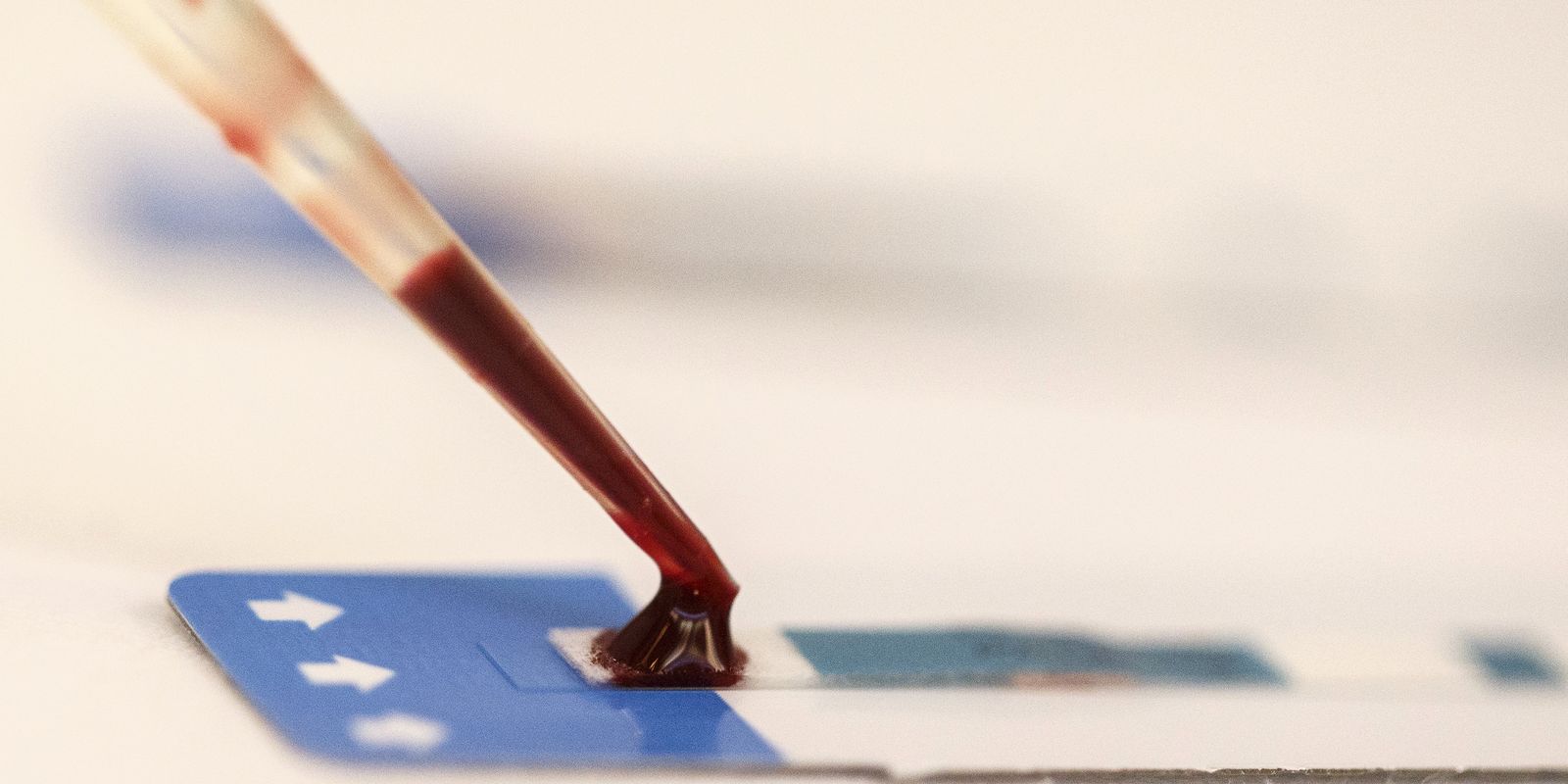 Unesco: A maioria dos jovens com HIV aprova o acolhimento nos serviços de saúde