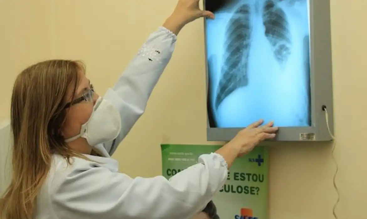 Tuberculose matou 5,8 mil brasileiros em 2022