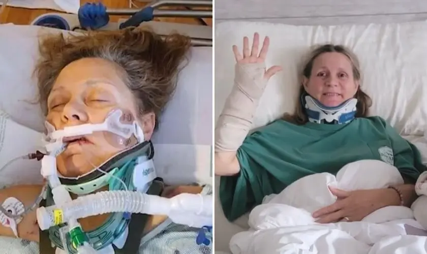 Após sofrer hemorragia cerebral em grave acidente, mulher testemunha milagre e usa sua história para levar pessoas a Jesus. Foto: Reprodução/CBN News.