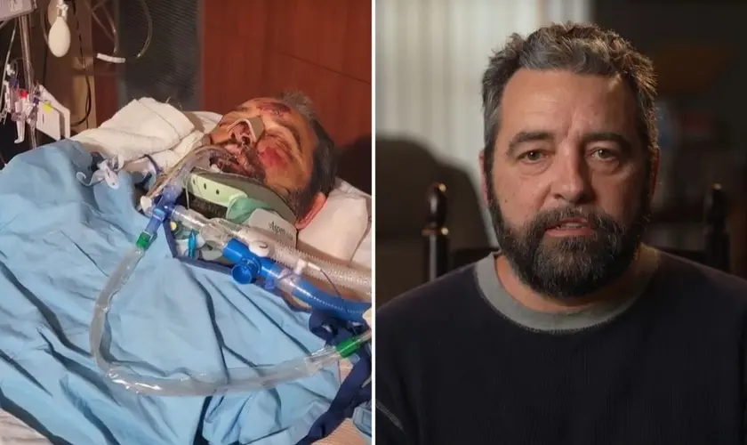 Um homem sobreviveu a um grave atropelamento nos EUA e chamou a atenção dos médicos pela recuperação considerada surpreendente. Foto: Reprodução/CBN News