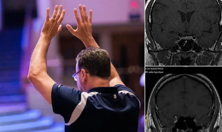 Homem na Holanda é curado de um tumor cerebral após participar de reuniões cristãs voltadas à oração e à busca por milagres. Foto: Imagem ilustrativa/Unsplash/Jesus Loves Austin/Instagram/Shakersplaces