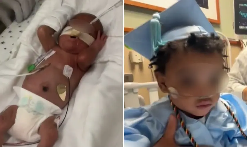 Bebê prematuro de apenas 24 semanas e cinco dias de gestação recebeu alta após passar quase um ano em uma UTI neonatal nos Estados Unidos. Foto: Reprodução/CBS News