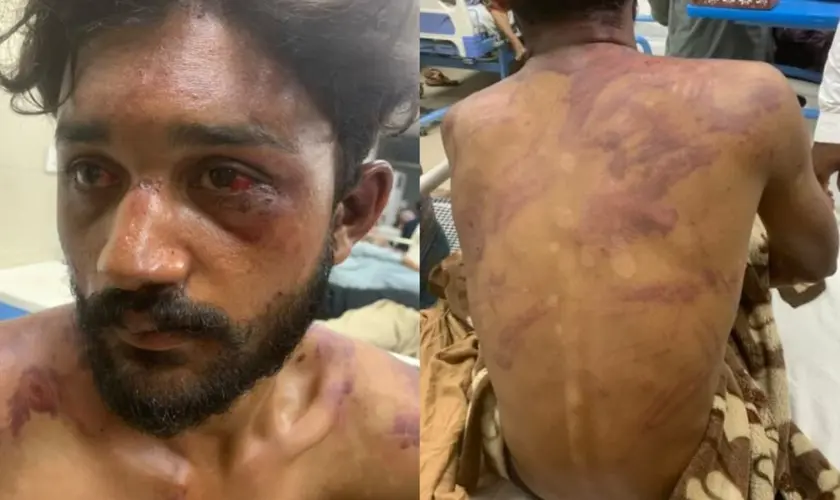 Jovem cristão de 17 anos é brutalmente espancado após tentar impedir assédio no Paquistão contra uma menina que estava a caminho da igreja. Foto: International Christian Concern