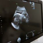 Nova lei em Maceió exige que mulheres visualizem imagens do feto e se informem sobre riscos antes de realizar abortos legalizados. Foto: Representativa.