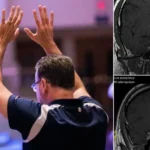 Homem na Holanda é curado de um tumor cerebral após participar de reuniões cristãs voltadas à oração e à busca por milagres. Foto: Imagem ilustrativa/Unsplash/Jesus Loves Austin/Instagram/Shakersplaces