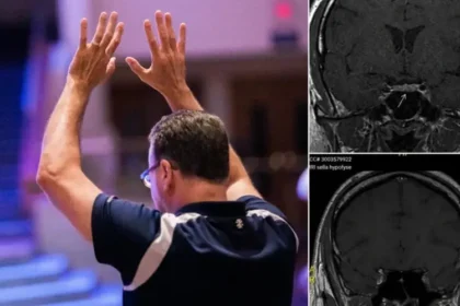 Homem na Holanda é curado de um tumor cerebral após participar de reuniões cristãs voltadas à oração e à busca por milagres. Foto: Imagem ilustrativa/Unsplash/Jesus Loves Austin/Instagram/Shakersplaces