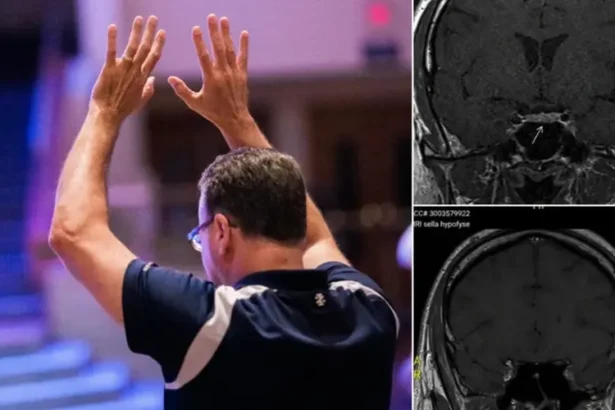 Homem na Holanda é curado de um tumor cerebral após participar de reuniões cristãs voltadas à oração e à busca por milagres. Foto: Imagem ilustrativa/Unsplash/Jesus Loves Austin/Instagram/Shakersplaces