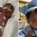 Bebê prematuro de apenas 24 semanas e cinco dias de gestação recebeu alta após passar quase um ano em uma UTI neonatal nos Estados Unidos. Foto: Reprodução/CBS News