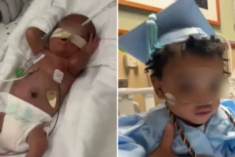 Bebê prematuro de apenas 24 semanas e cinco dias de gestação recebeu alta após passar quase um ano em uma UTI neonatal nos Estados Unidos. Foto: Reprodução/CBS News