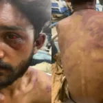 Jovem cristão de 17 anos é brutalmente espancado após tentar impedir assédio no Paquistão contra uma menina que estava a caminho da igreja. Foto: International Christian Concern