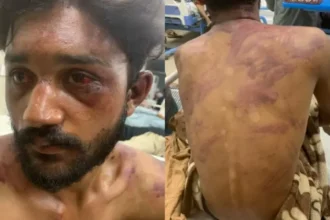 Jovem cristão de 17 anos é brutalmente espancado após tentar impedir assédio no Paquistão contra uma menina que estava a caminho da igreja. Foto: International Christian Concern